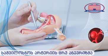 საშვილოსნოს არტერიის ცრუ ანევრიზმა