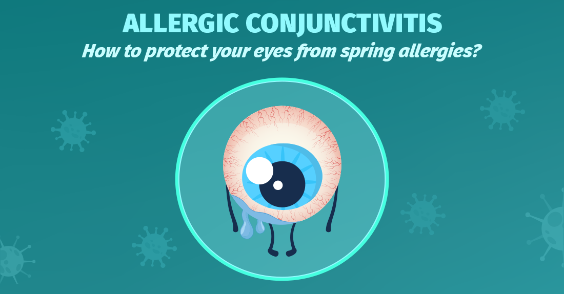 ალერგიული კონიუნქტივიტი