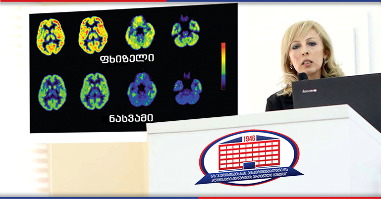 ახალი წლის განწყობა ნაბახუსევმა რომ არ გაგვიფუჭოს – როგორ მოვიქცეთ ალკოჰოლით ინტოქსიკაციის დროს?