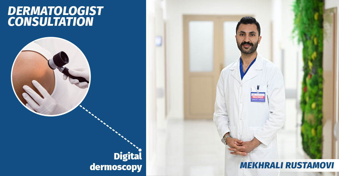 ციფრული დერმატოსკოპია