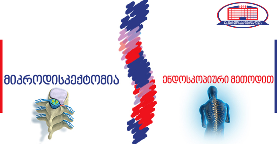 ხერხემლის არეში ტკივილის მკურნალობის ინოვაციური მეთოდი – ქირურგიის ეროვნულ ცენტრში მალთაშუა დისკის თიაქარი ენდოსკოპიური მეთოდით ამოკვეთეს