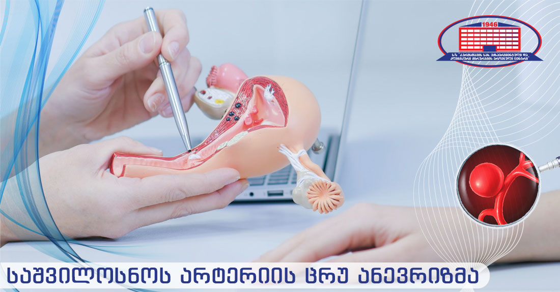 საშვილოსნოს არტერიის ცრუ ანევრიზმა