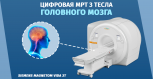 Магнитно-резонансная томография головного мозга