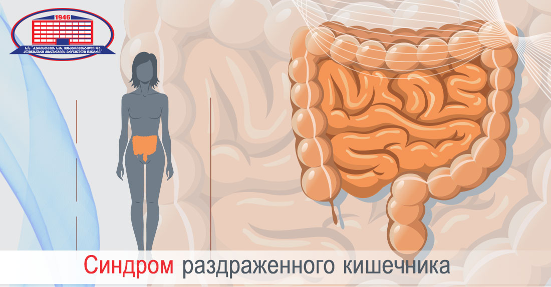 Синдром раздраженного кишечника